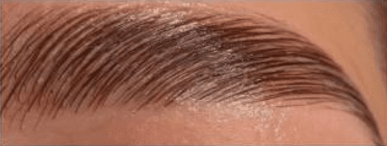 Brow Lamination